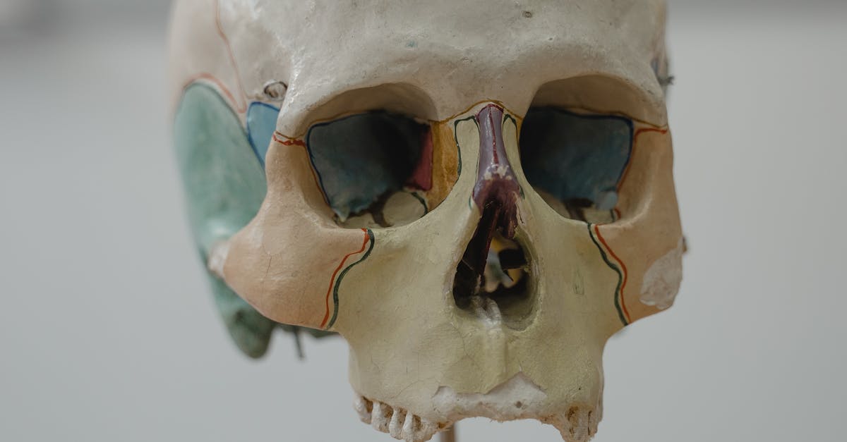 The Role of Self-Assessment in Agile Education